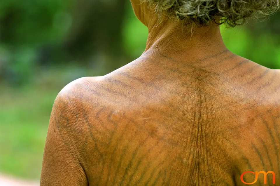 Traditional Women’s Tattoos of Ambae