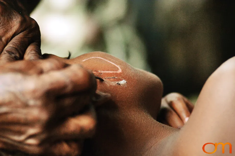 Facial Scarification in Langa Langa Lagoon
